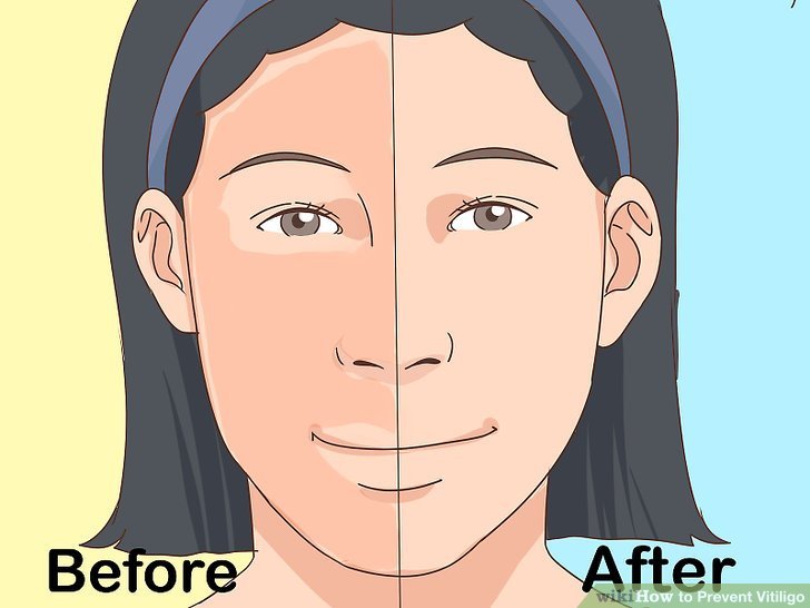 Best Skin Specialist in Surat