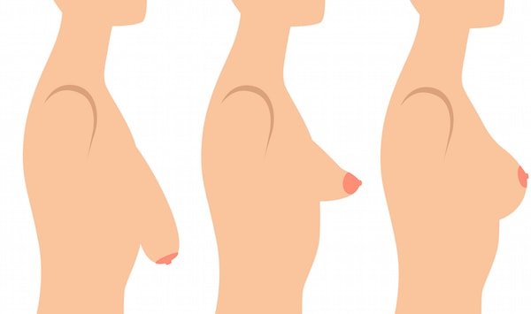 Breast Surgery In Surat