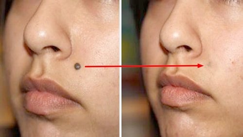 Cosmetic Surgeon in Surat