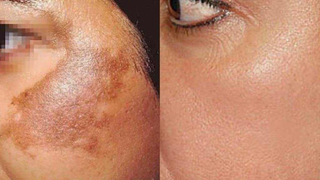 Cosmetic Surgery in Surat