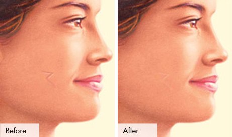 Skin Specialist in Surat