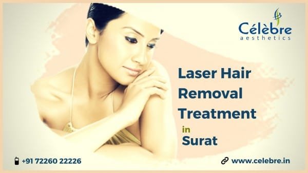 Laser Hair Removal Treatment