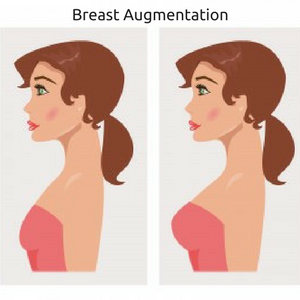 Breast Surgery in Surat