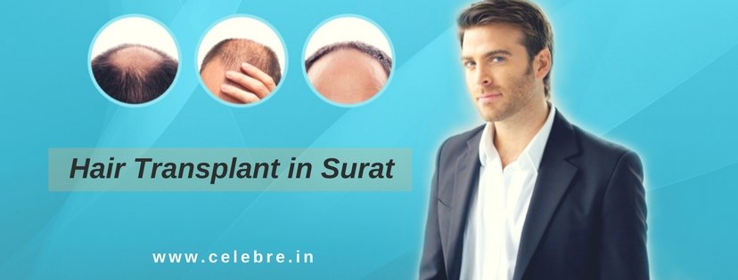 Hair Transplant in Surat