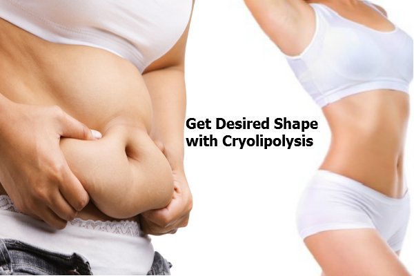 Liposuction Surgery in Surat
