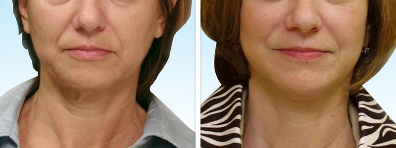 Best Skin Specialist in Surat