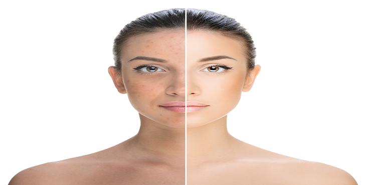 Best Skin Doctor in Surat