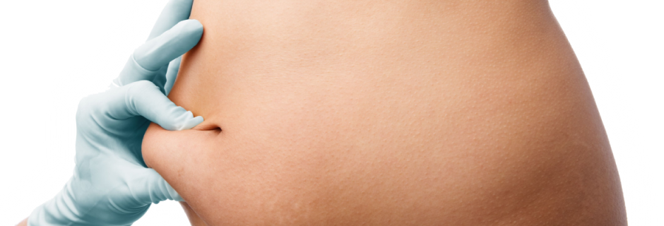 Perfect Slim Obesity Clinic Surat Gujarat