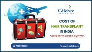 Hair Transplant Cost in India