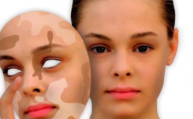 Best Skin Specialist in Surat