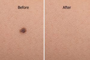 Best Skin Specialist Doctor in Surat