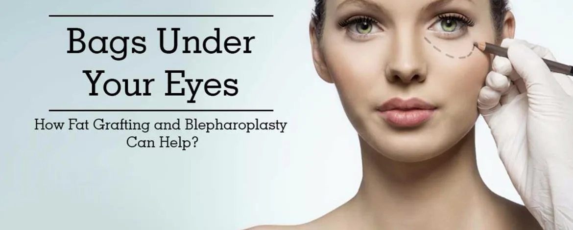 bags-under-your-eyes