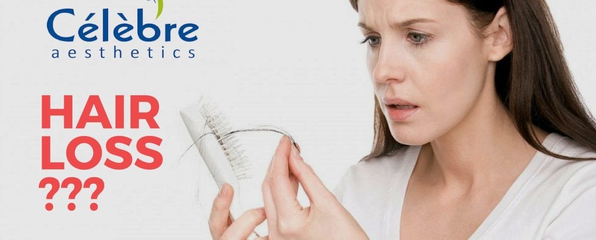 Hair-Loss-