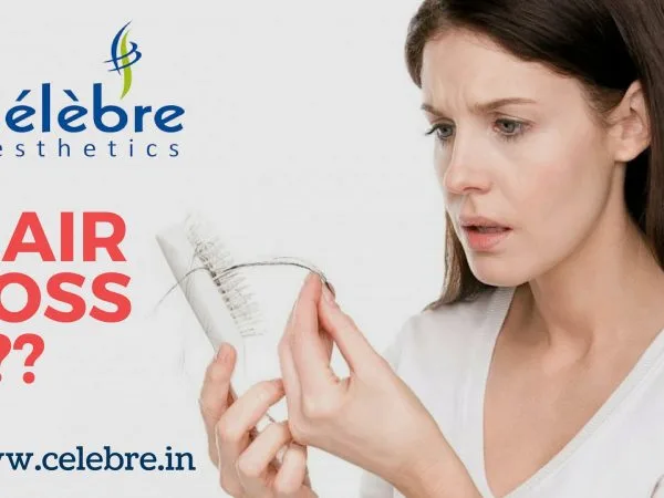 Hair-Loss-