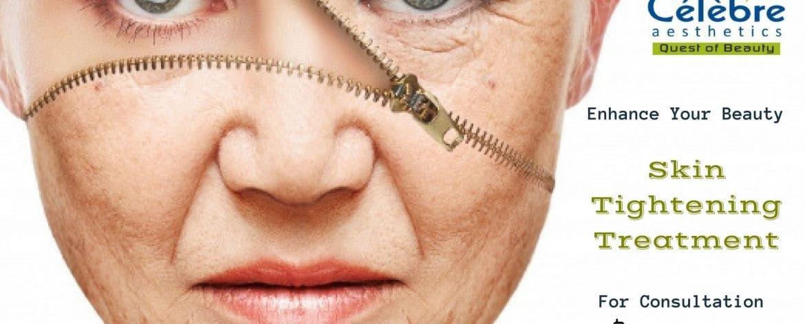 Skin-Tightening-Treatment-in-Surat