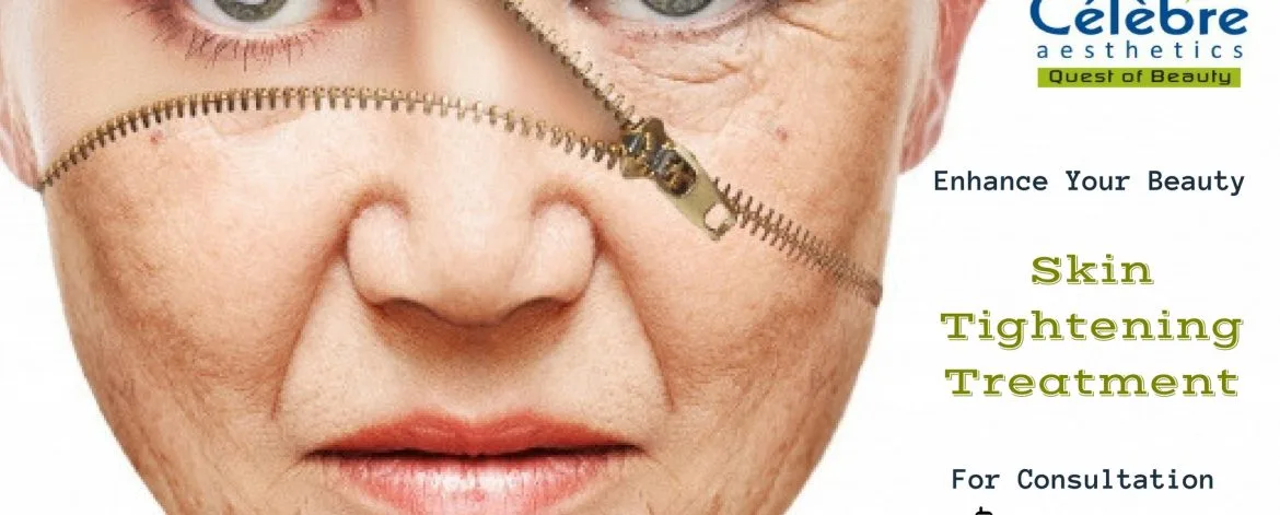 Skin-Tightening-Treatment-in-Surat