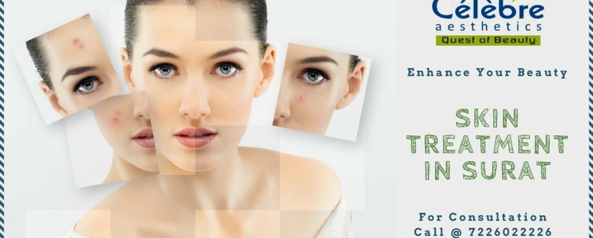 Skin-Treatment-in-Surat-1