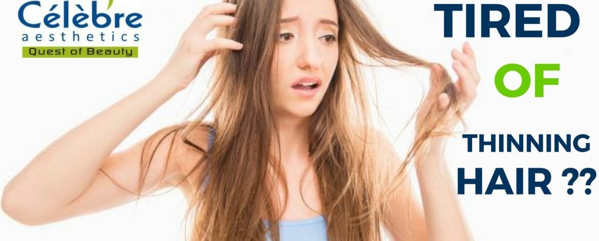 Tired-of-thinning-Hair