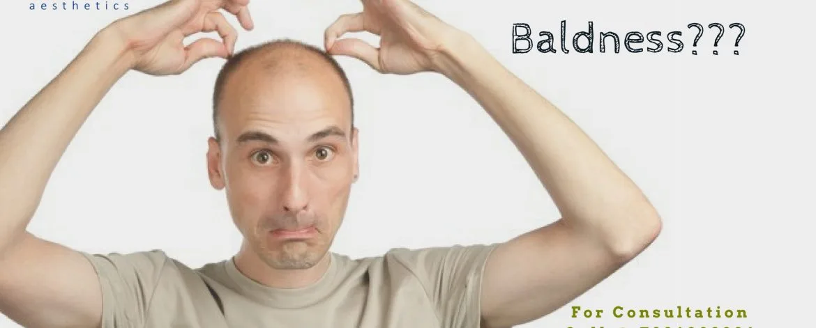 Tired-with-your-baldness