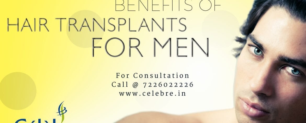 Benefits-of-Hair-Transplant