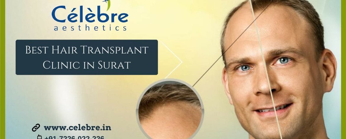 Best-Hair-Transplant-Clinic-in-Surat-Celebre-Aesthetics