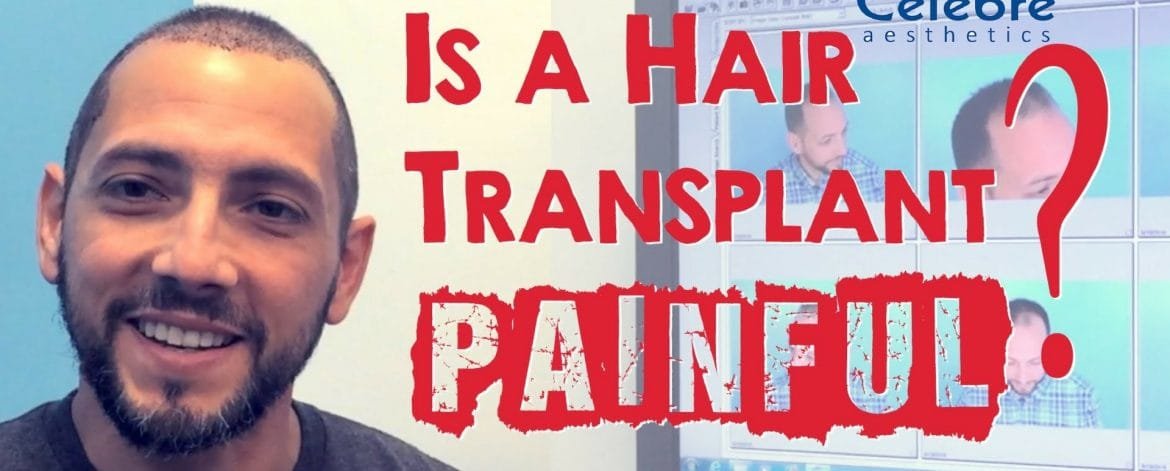 Is-a-hair-transplant-painful-