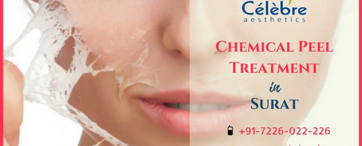 Chemical-Peel-Treatment-in-Surat-1