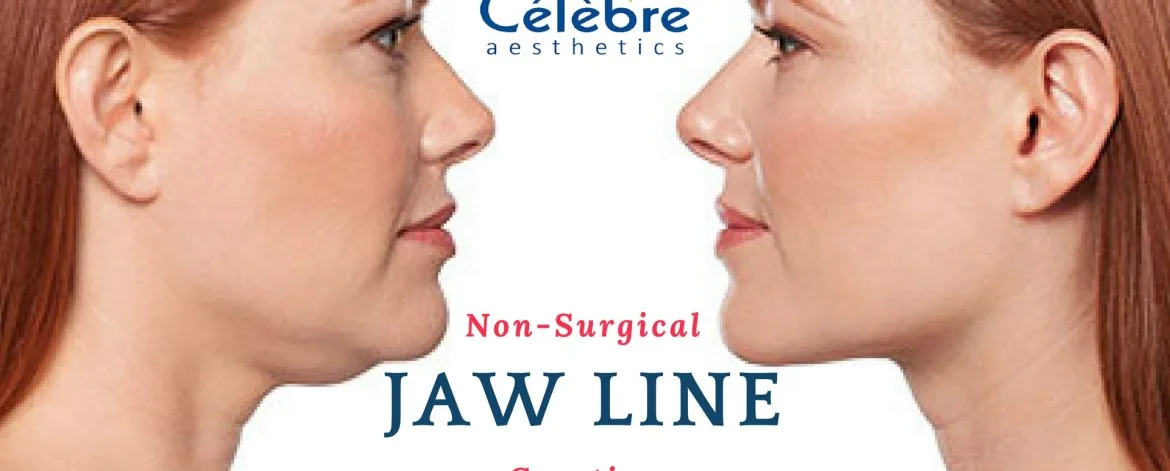 Non-Surgical-Jaw-Line-Creation