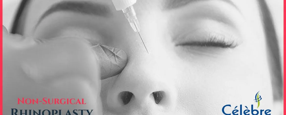 Non-Surgical-Rhinoplasty-in-Surat
