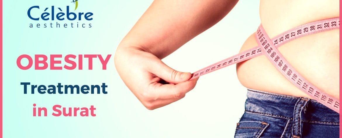Obesity-Treatment-in-Surat