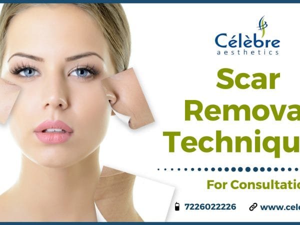 Scar-Removal-Techniques-and-Treatment-in-Surat