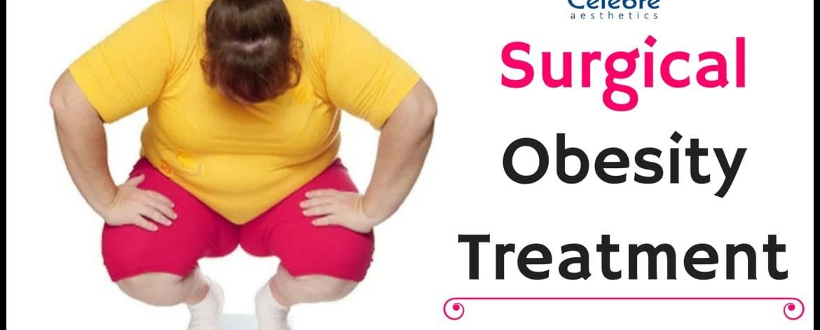 Surgical-Obesity-Treatment