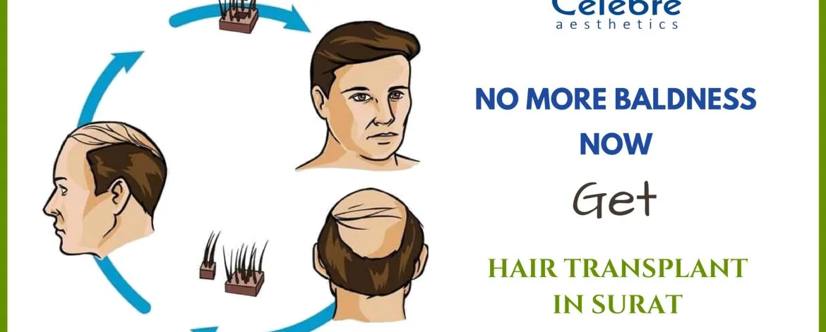 Hair-Transplant-in-Surat-1