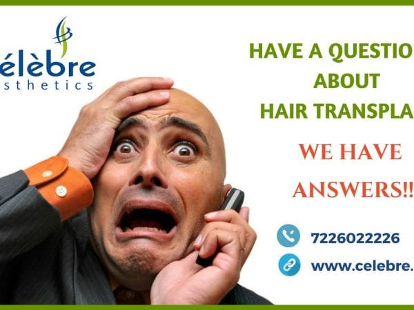 FAQ-Hair-Transplant-in-Surat