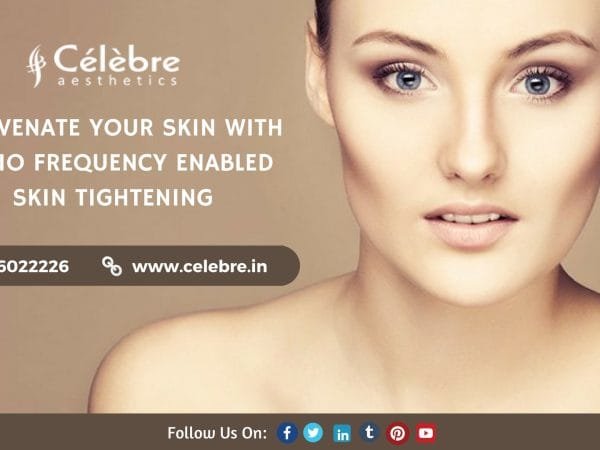 Laser-Hair-Restoration-Treatment-in-Surat-1