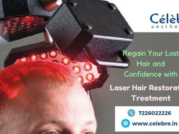 Laser-Hair-Restoration-Treatment-in-Surat