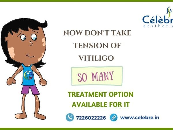 Skin-Specialist-in-Surat