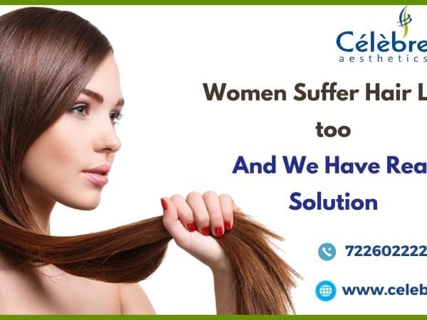 Best-Hair-Transplant-in-Surat-for-Women