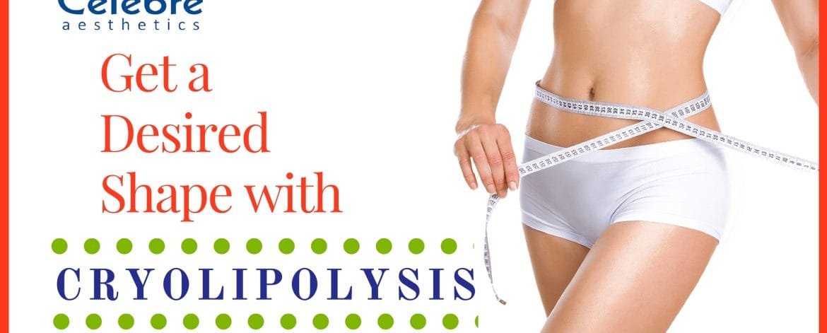 Cryolipolysis-Treatment