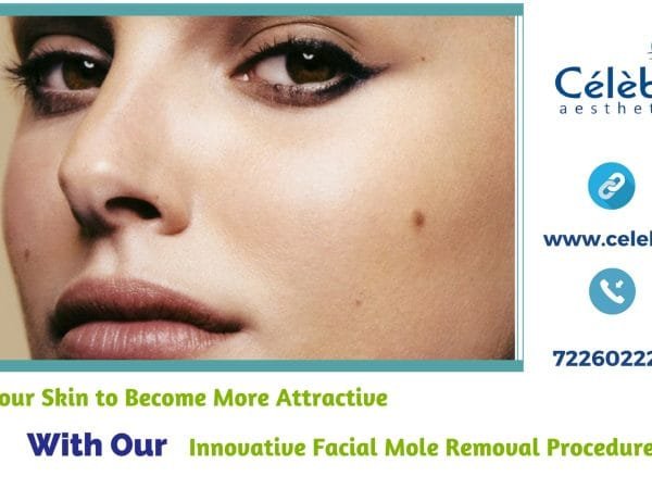 Facial-Mole-Removal-in-Detail