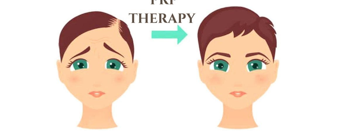 PRP-Therapy