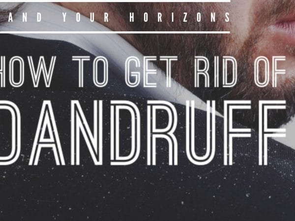 Dandruff-Causes-and-Treatment