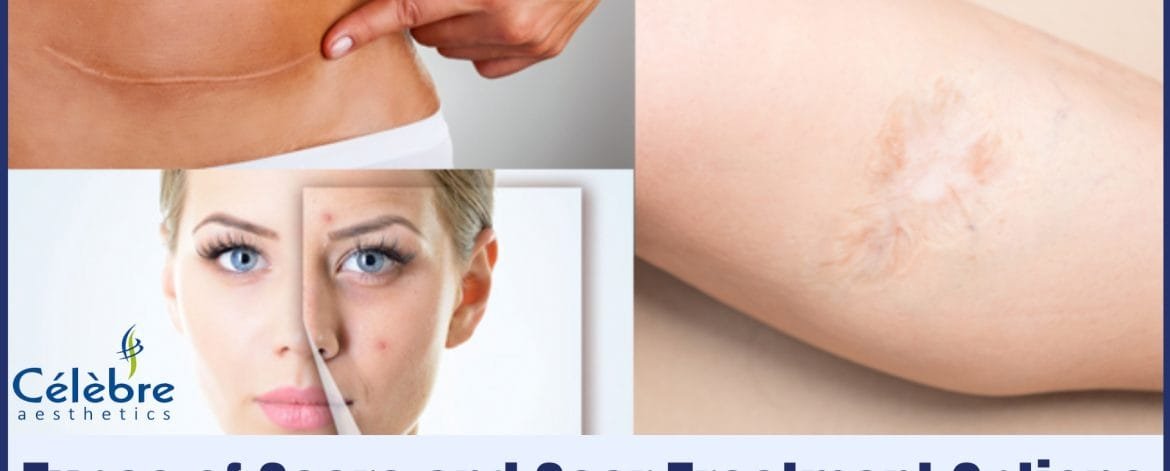 Scar-Treatment-Options-in-Surat