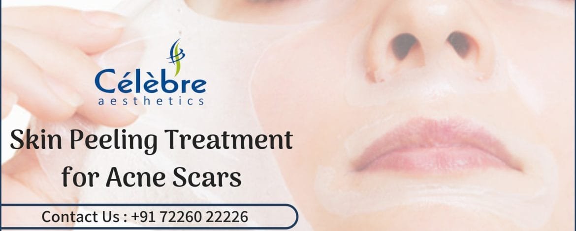 Skin-Peeling-Treatment