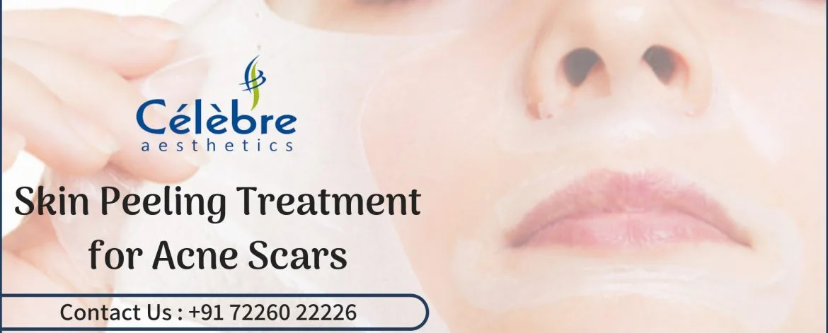 Skin-Peeling-Treatment