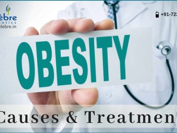 Causes-of-Obesity-Effective-Treatment-Option