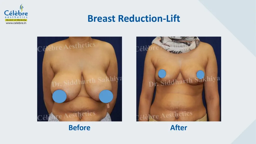 PPT (1)_page-0025