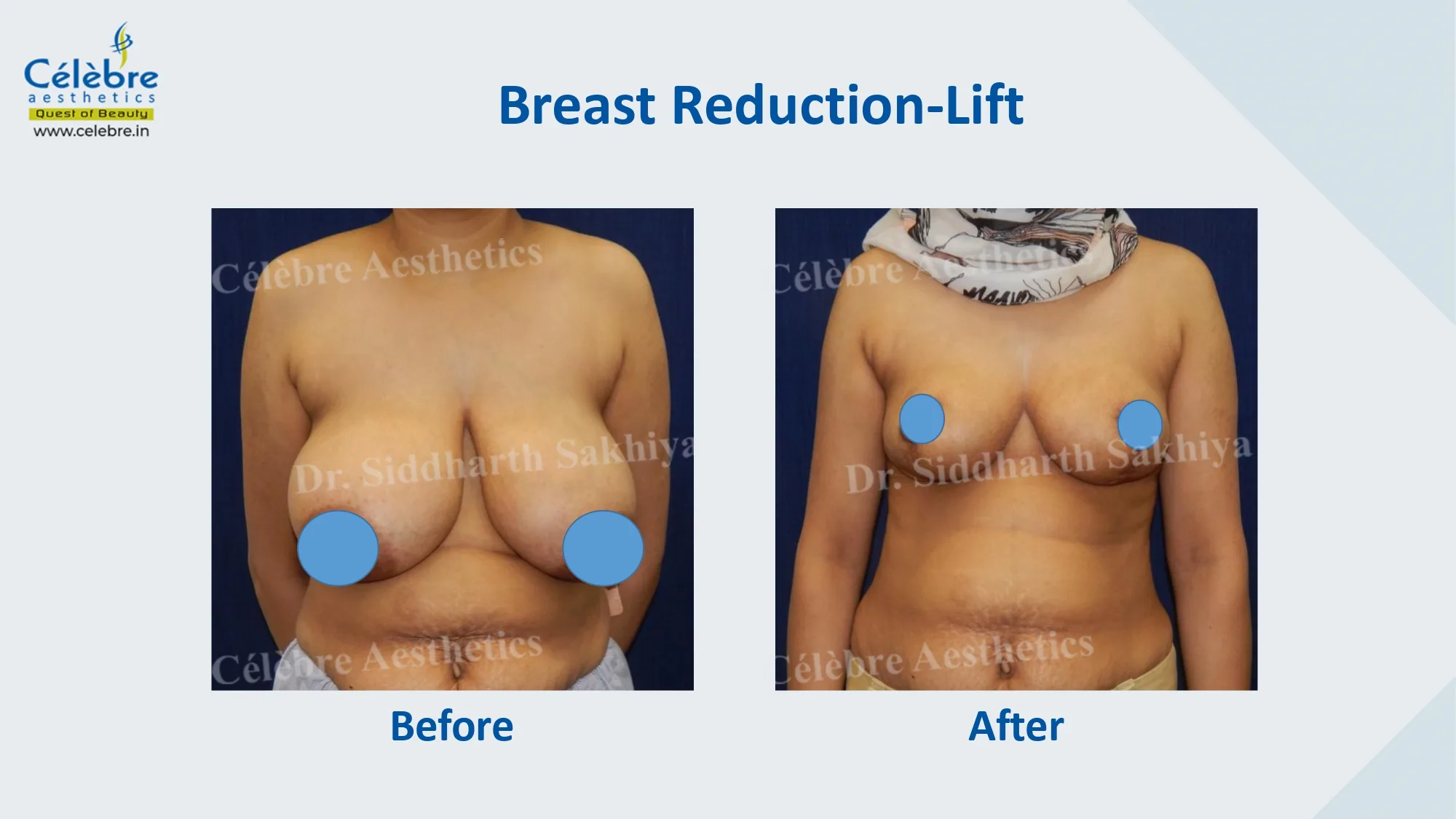 PPT (1)_page-0025