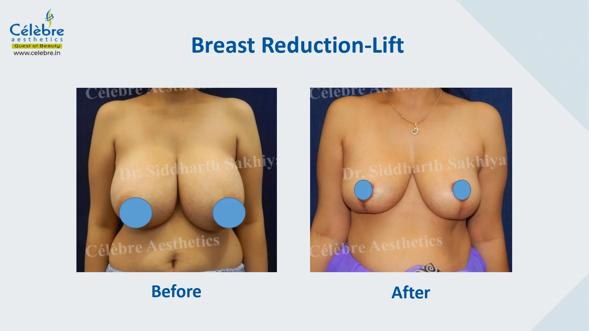 PPT (1)_page-0026