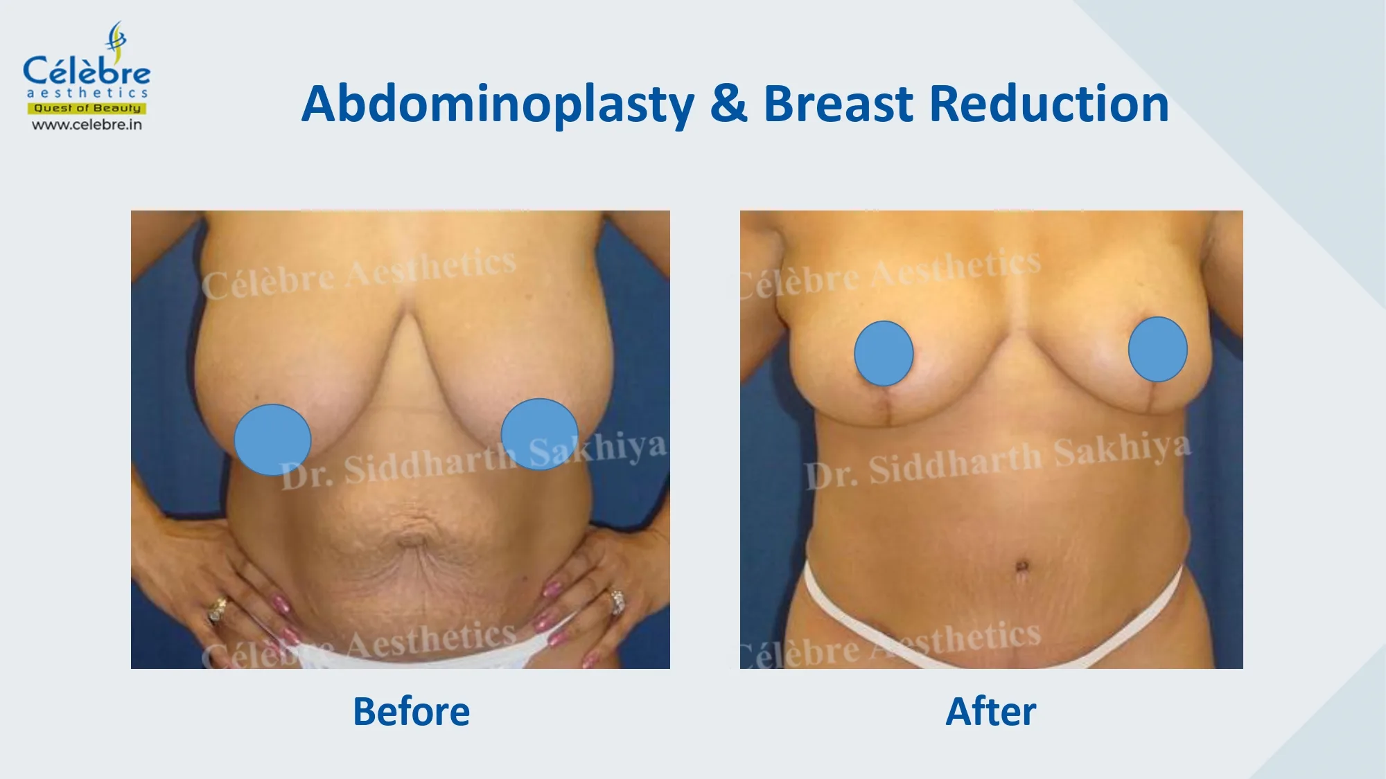 PPT (1)_page-0028
